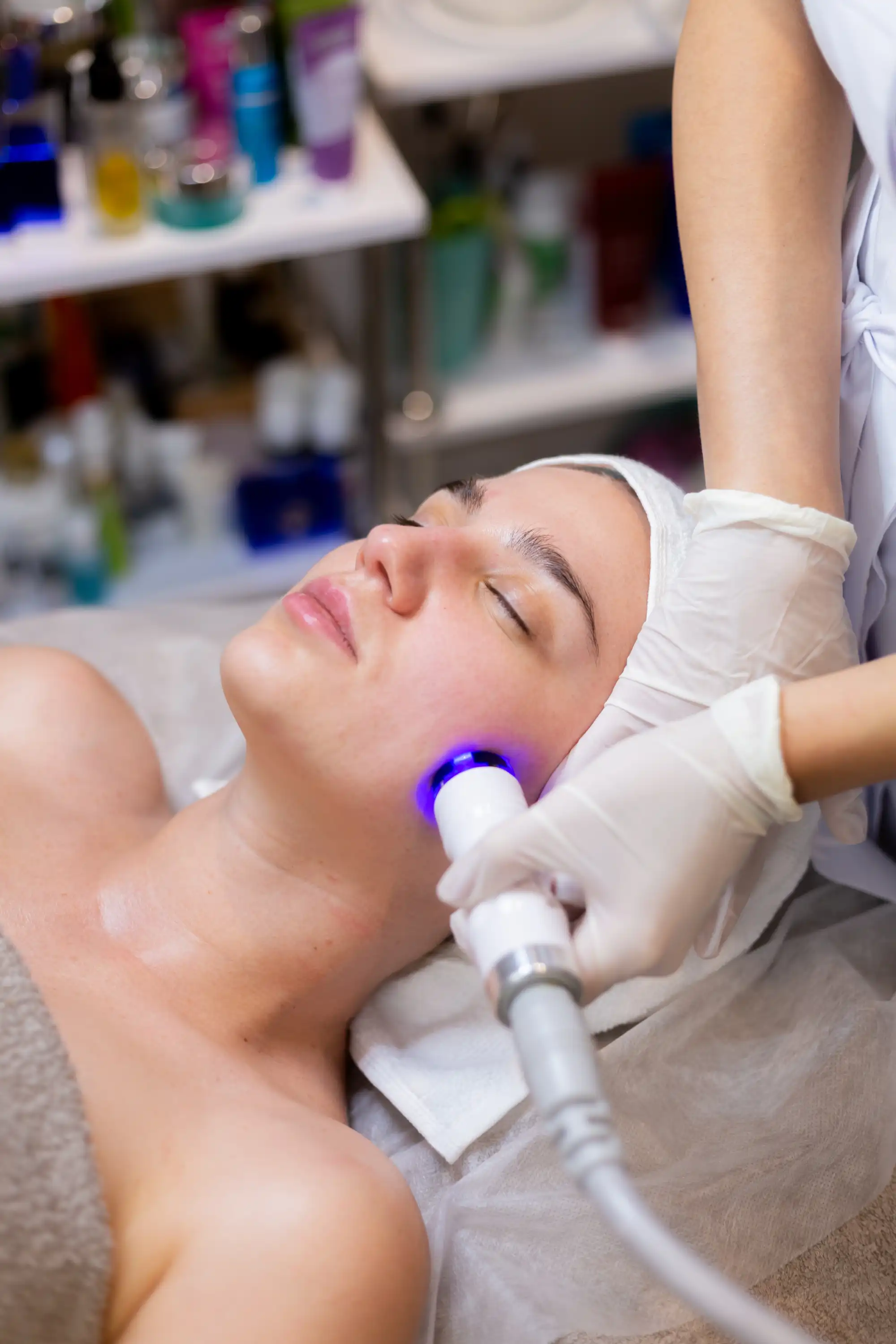 Epilazione Laser Viso